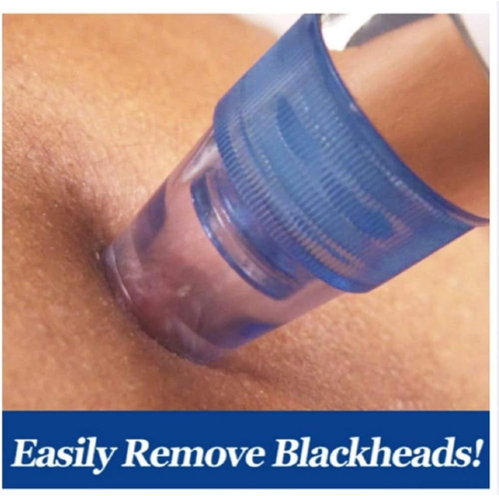 Pore Cleaning Device – Blackhead Remover Vacuum, USB Rechargeable image 3