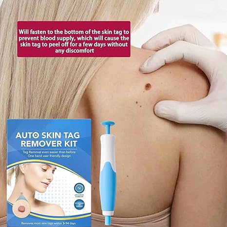 Acrochordon Skin Tag Remover Kit – 2-in-1 Fast & Painless Solution image 4