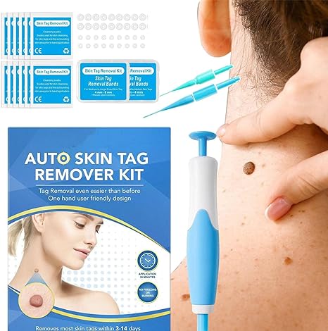 Acrochordon Skin Tag Remover Kit – 2-in-1 Fast & Painless Solution
