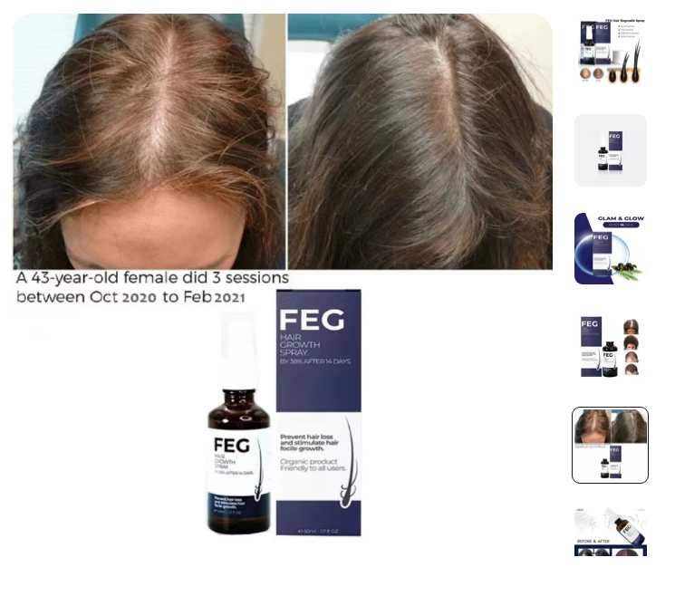 FEG Hair Growth Spray – Stop Hair Fall, Regrow Naturally & Strengthen Roots image 4